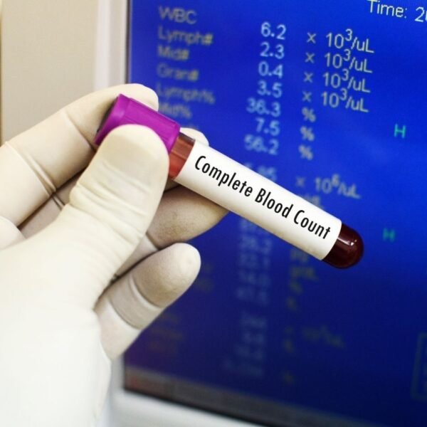 CBC (Complete Blood Count)