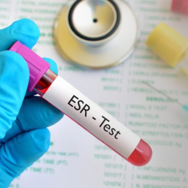 ESR (Erythrocyte Sedimentation Rate)